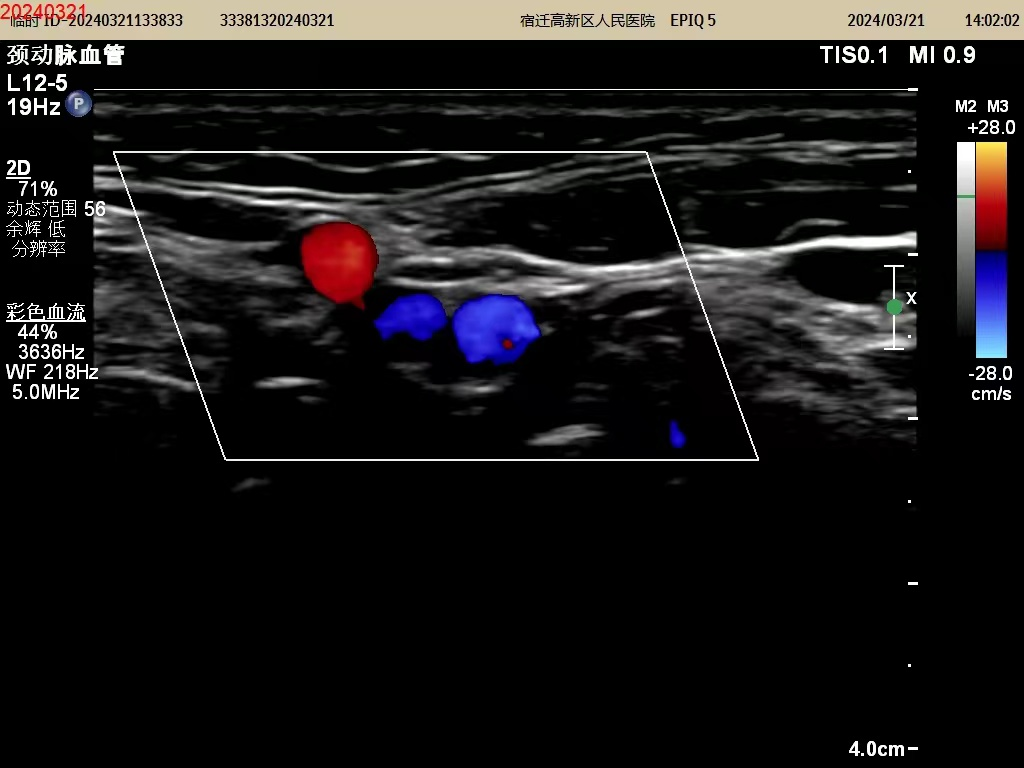 彩超都有哪些探头彩超知识小科普_https://www.jmylbn.com_新闻资讯_第1张