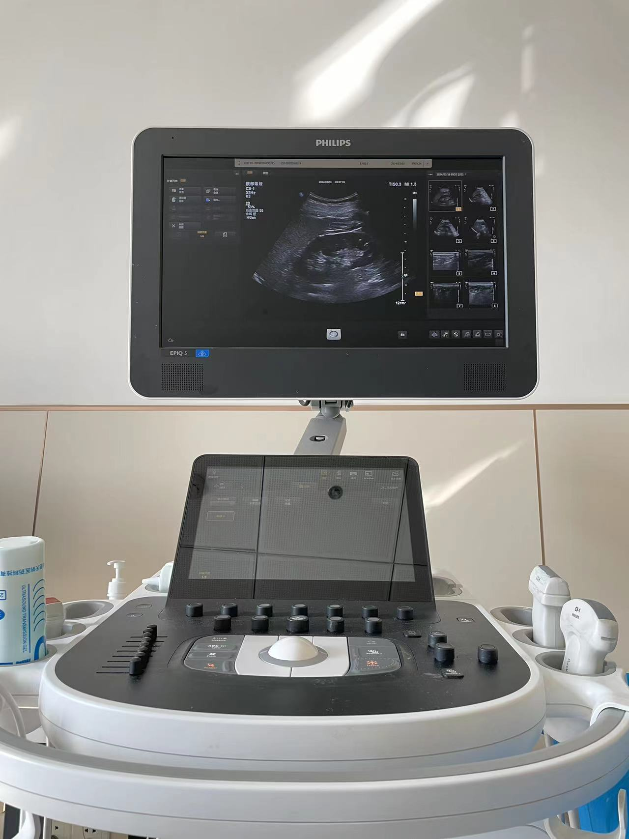 彩超都有哪些探头彩超知识小科普_https://www.jmylbn.com_新闻资讯_第4张