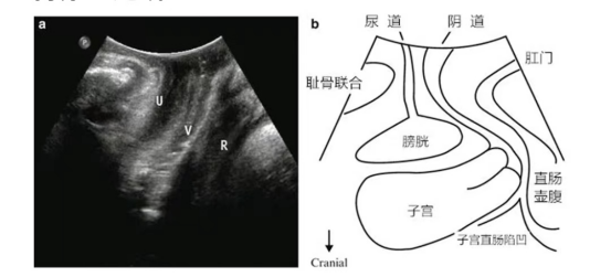 fd73708a5bc36634c30aba16310eba0f.png